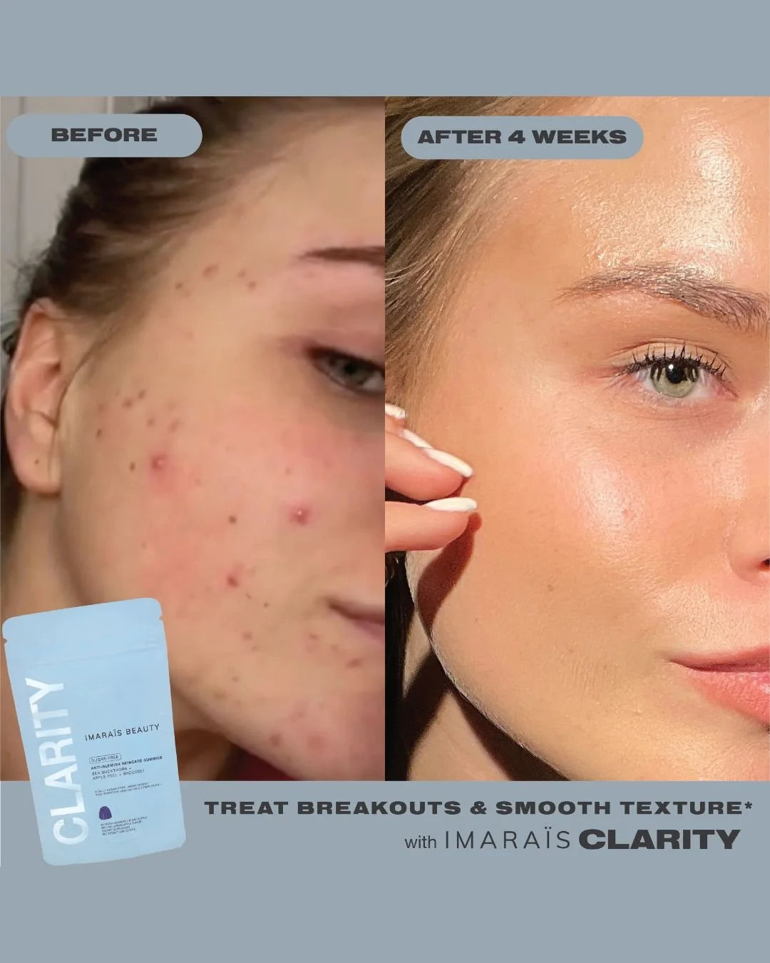 Anti-Acne Gummies | CLARITY - IMARAÏS 