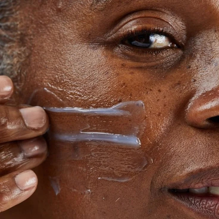 Microneeling du visage à Laval chez Browgeous Esthétique. Soin facial réalisé avec des micro-aiguilles.